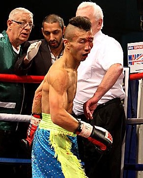 SHINNY Bayaar pictured after losing his British title following an accidental clash of heads with Paul Edwards in Belfast 12 months ago. SHINNY Bayaar pictured after losing his British title following an accidental clash of heads with Paul Edwards in Belfast 12 months ago.