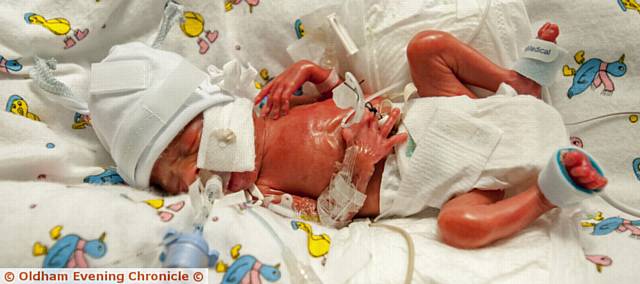 Premature twins . . . Eric James Royales