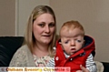 Adele Lichfield with her son Oliver Young (15 months) who suffers from Apert syndrome, a rare problem with his skull.