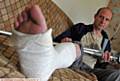 Tom Bebbington and girlfriend were assaulted and suffered a broken ankle each.