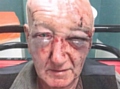 assault victim Derek Laidlaw