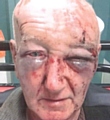 ASSAULT victim Derek Laidlaw